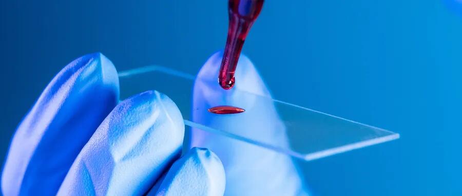 【原創研究】血液制品行業投研報告之二:國內企業分離提純工藝仍有較大提升空間